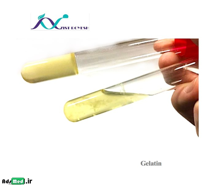 محیط کشت ژلاتیناز (لوله ای) زیست رویش